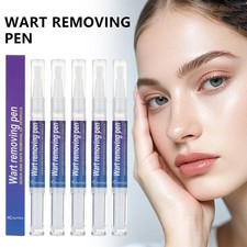 5 5ml Warts Removal Pen Eliminate Wart Pen Wart Liquid Hand Foot Warts Remove