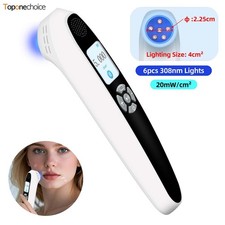 308nm UVB Light Therapy Device 6 Diodes Rechargeable for Face Leg Hand Skin Care