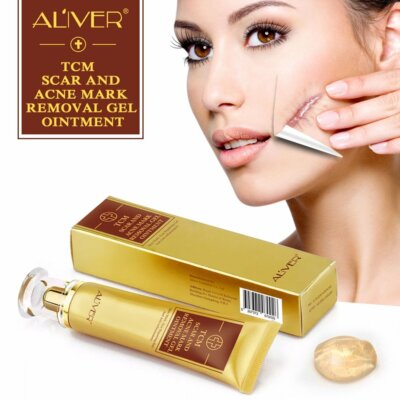 TCM Pimple Scar and Acne Mark Spots Removal Gel Ointment Skin Blemish Cream US