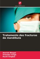Amrish Bhagol (U. A.) | Tratamento Das Fracturas Da MandíBula | Taschenbuch