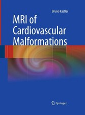 Bruno Kastler | MRI of Cardiovascular Malform...