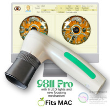 2026 Iridology Camera Fit MAC 12 MP HD 30X Iriscope 9811 Pro Iris CCD Analysis
