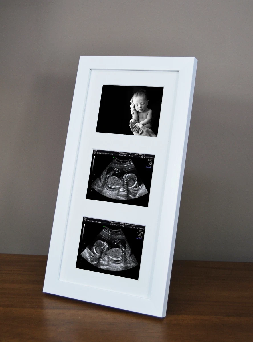 Photo frames for baby scans online