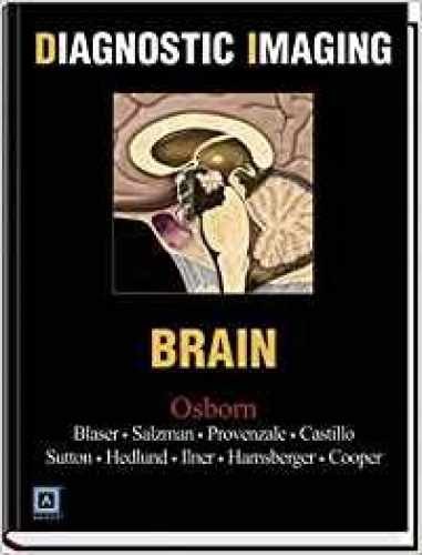 Diagnostic Imaging: Brain - Hardcover, by Anne Osborn; Susan Blaser; - Very Good