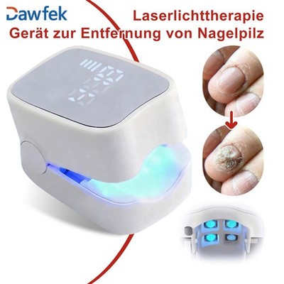 Lasergerät zur Nagelpilzbehandlung Onychomykose Laserbehandlungsgerät Nagelpilz