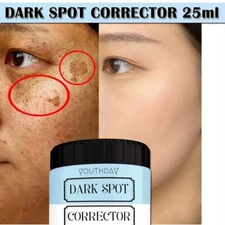 Melasma Cream (25g) for skin pigmentation like melasma, chloasma