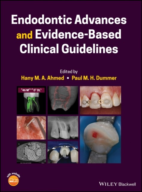 Endodontic Advances and Evidence-Based Clinical Guidelines (Hardback Book)