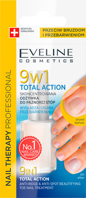 Eveline Cosmetics Total Action 9 in 1 Toe Nail Treatment