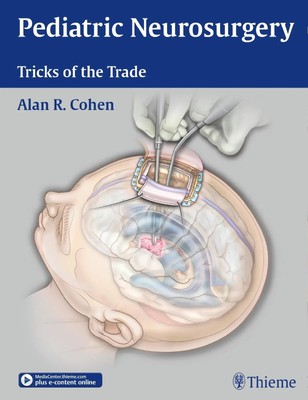 Pediatric Neurosurgery: Tricks of the Trade | Alan R. Cohen | Buch | 912 S.