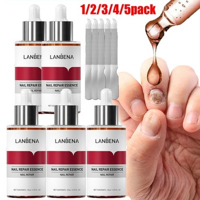 5/3x LANBENA Nail Repair Essence Remove Onychomycosis Serum Fungal Treatment Toe