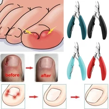 1Pcs Nail Ingrown Nipper Toenail Clippers Cutter Cuticle Scissors Manicure Tools