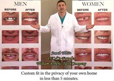 MEDIUM SIZE INSTANT SMILE BEAUTIFUL PERFECT TEETH 2 PKG BEADS dentures MAKEOVER