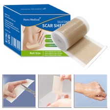 New Scar Gel Patch Roll Painless For Keloid Surgery Burn Acne Scar Repair Tools