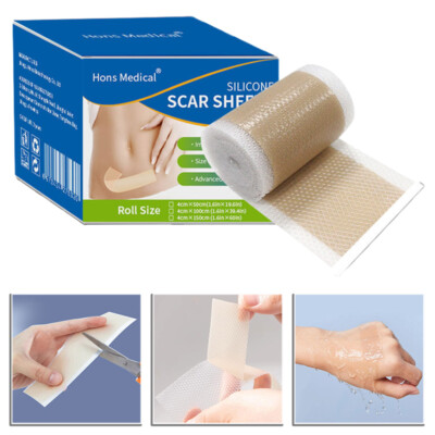 Scar Gel Patch Roll Painless For Keloid Surgery Burn Acne Scar Repair Tools New