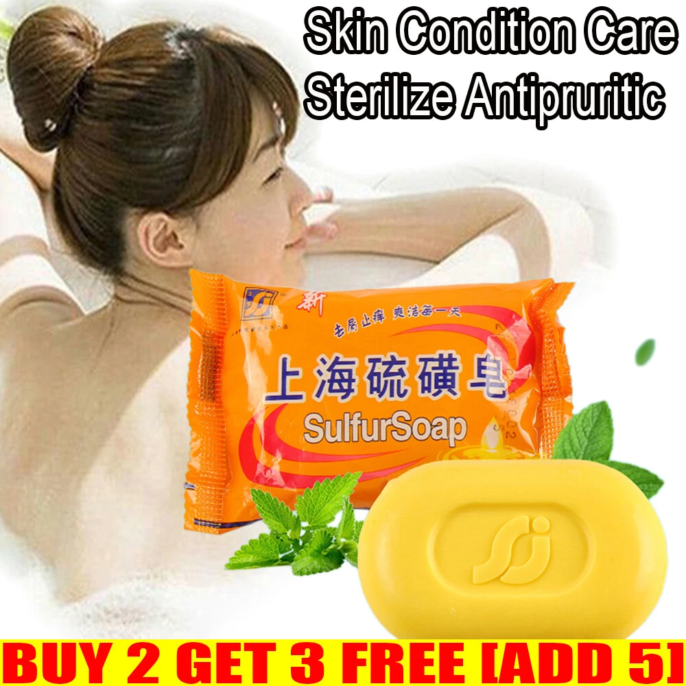 Soap for pimples deals
