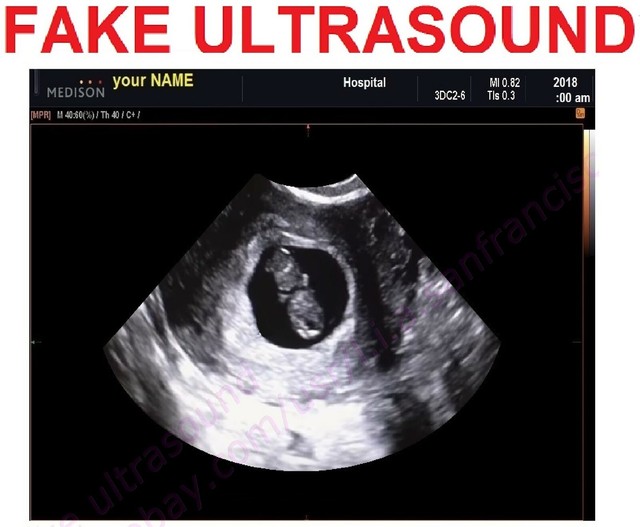 Fake Ultrasound sonogram Pozitive fake baby prank your family joke fun