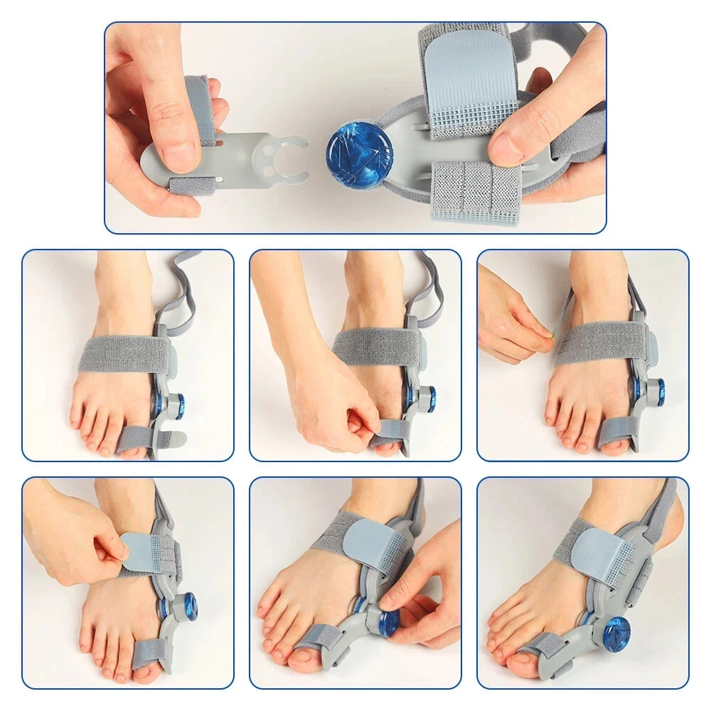 Bunion Fix Toe Valgus Corrector Adjustable Orthosis Women Men Splints*