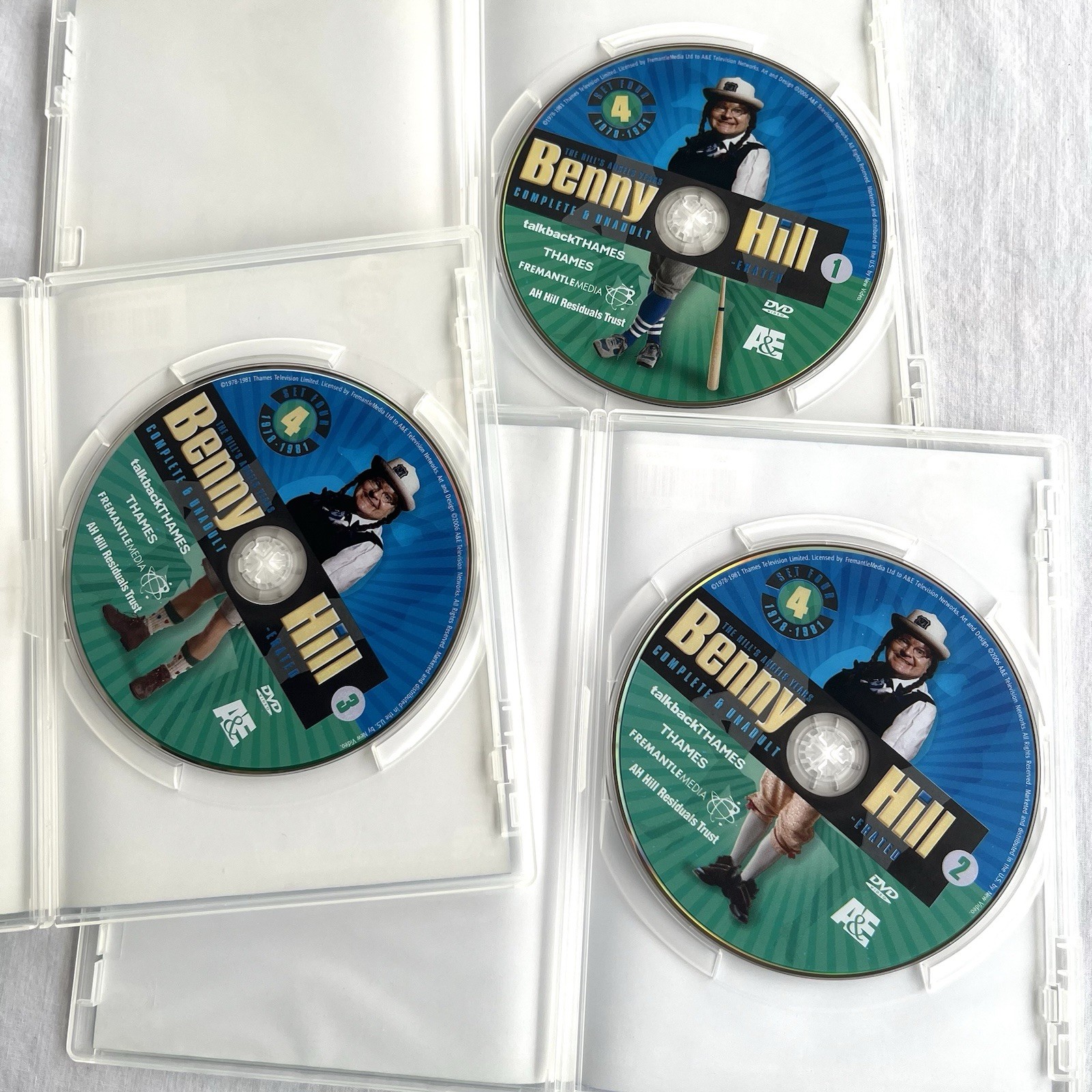 Benny Hill Complete & Unadulterated - The Hill's Angels Years Set 1978-1981