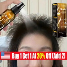 Biotin Hair Growth Spray Anti Hair Loss Fast Regrowth Scalp Treatment Serum