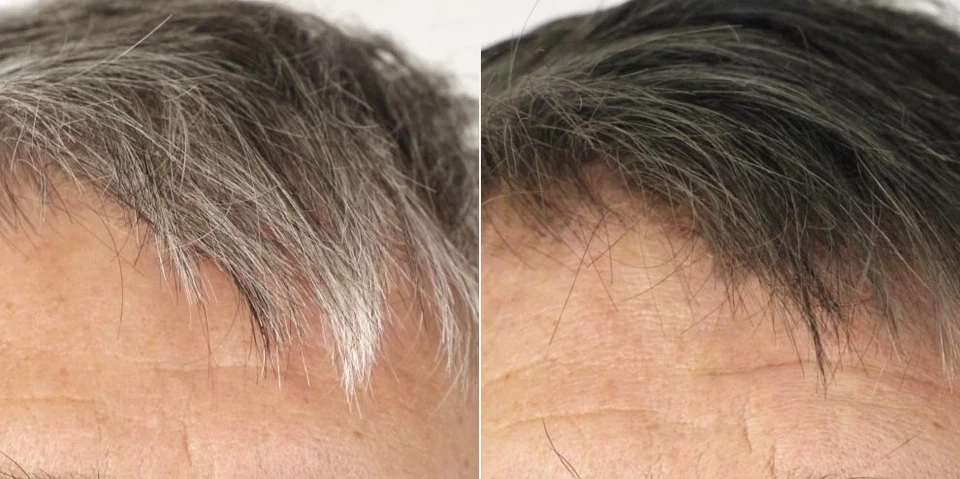 LIMPIEZA DE PARÁSITOS PARA HUMANOS ORGÁNICA - CABELLO ANTI GRIS - COMBO ANTIPARASITARIO 2B -  Foto 4 de 4