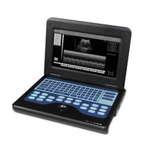 Digitaler Ultraschall-Scanner, tragbare Laptop-Maschine, konvexe Sonde 3.5MHZ,CE