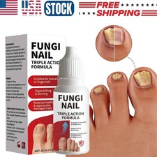 Fungi-Nail Anti-Fungal Liquid Solution Kills Fungus That Can Lead To Nail