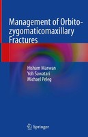 Hisham Marwan (U. A.) | Management Of Orbito-Zygomaticomaxillary Fractures