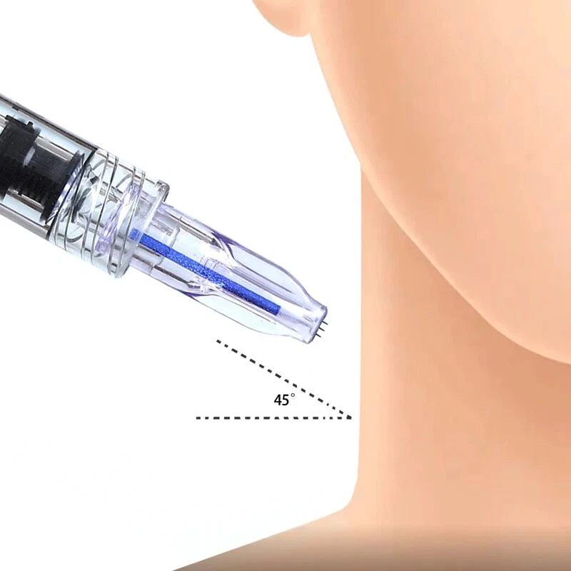 Nanosoft 34G 1.2mm 1.5mm Relleno Mano Tres Agujas para Anti Envejecimiento Alrededor de los Ojos Foto 2 de 4