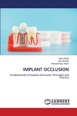 Implant Occlusion by Neha Ahuja Paperback Book