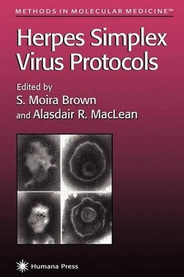 Herpes Simplex Virus Protokolle - 9781617370137
