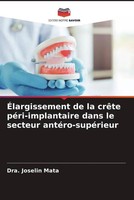 Dra. Joselin Mata | ÉLargissement De La CrêTe PéRi-Implantaire Dans Le...