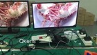 Vidéo 1 sur 1