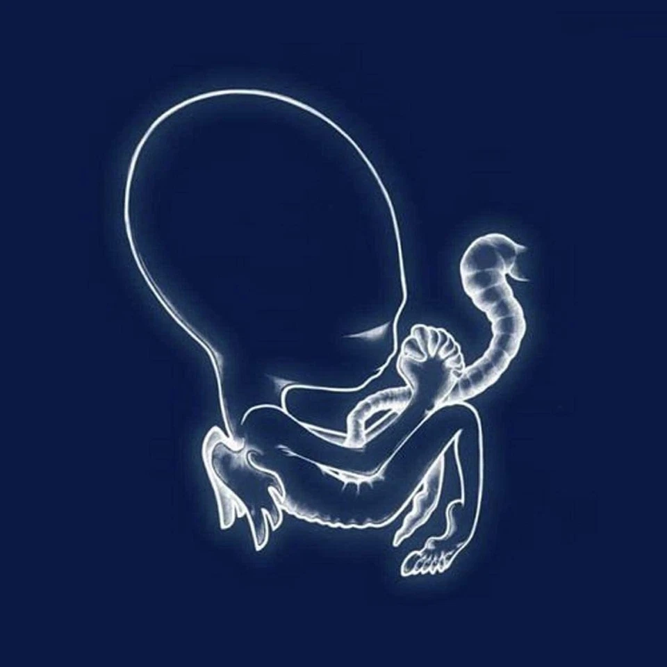 Sigur Rós Ágætis Byrjun (Vinyl) 12" Album - Imagen 1 de 1