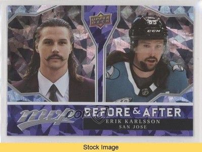 2021-22 Upper Deck MVP Before and After Erik Karlsson #BA-6 READ 0s9c