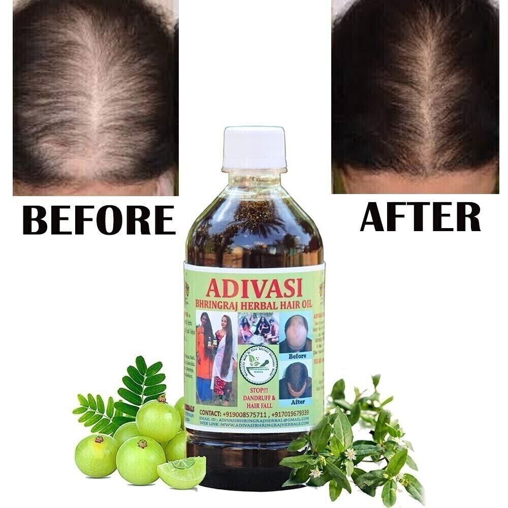 Huile Capillaire Ayurvédique Adivasi Bhringraj 100ml - Naturelle, Pour Croissance Et Force Des Cheveux