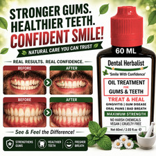 Tooth & Gum Disease Oil - Bleeding Gum Treatment Lasting Gum Comfort 60 Ml