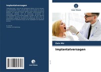 Implantatversagen Zain Mir Taschenbuch 180 S. Deutsch 2024 Verlag Unser Wissen
