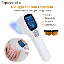 308nm Excimer Device Phototherapy Handheld UVB Light for Skin 5-50mW/cm2