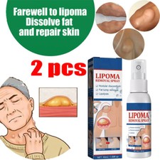 2X Lipomheilung Reduction Spray, Instant LumpFree Lipoma Removal Spray USA Hot