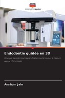 Endodontie GuidéE En 3D Anshum Jain