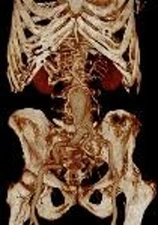 Mind Cosmology Hardcover Norvell