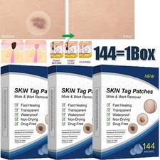 720pc Skin Tag Remover Patches Quick Effective Mole and Wart Pad Removal Sticker