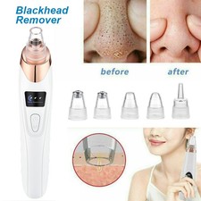 Electric Face Nose Blackhead Remover Pore Cleaner Pimple Acne Vacuum Suction