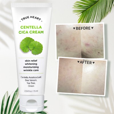 cica cream benefits