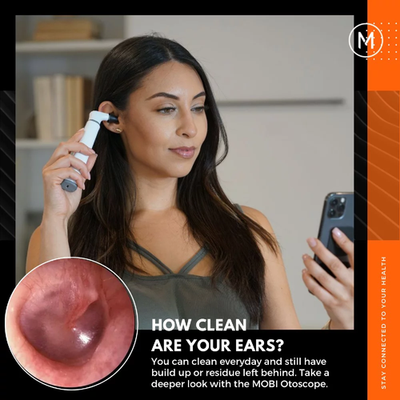 #ad MOBI 70676 CONNECT Smart Wi Fi Otoscope for Ears Nose amp; Throat with HD Camera $16.20