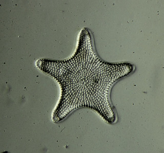 Vintage microscope slide by Brian Darnton. Diatom. Triceratium antediluvianum...