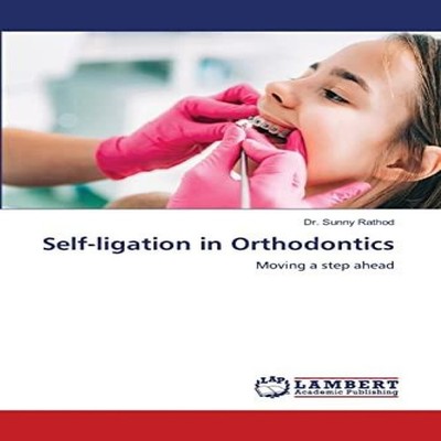 Self-ligation in Orthodontics Dr. Sunny Rathod Paperback KS OmniS