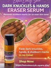 Belove Beauty Skin Knuckle & Hand Serum for Dark Spots & Even Skin Tone