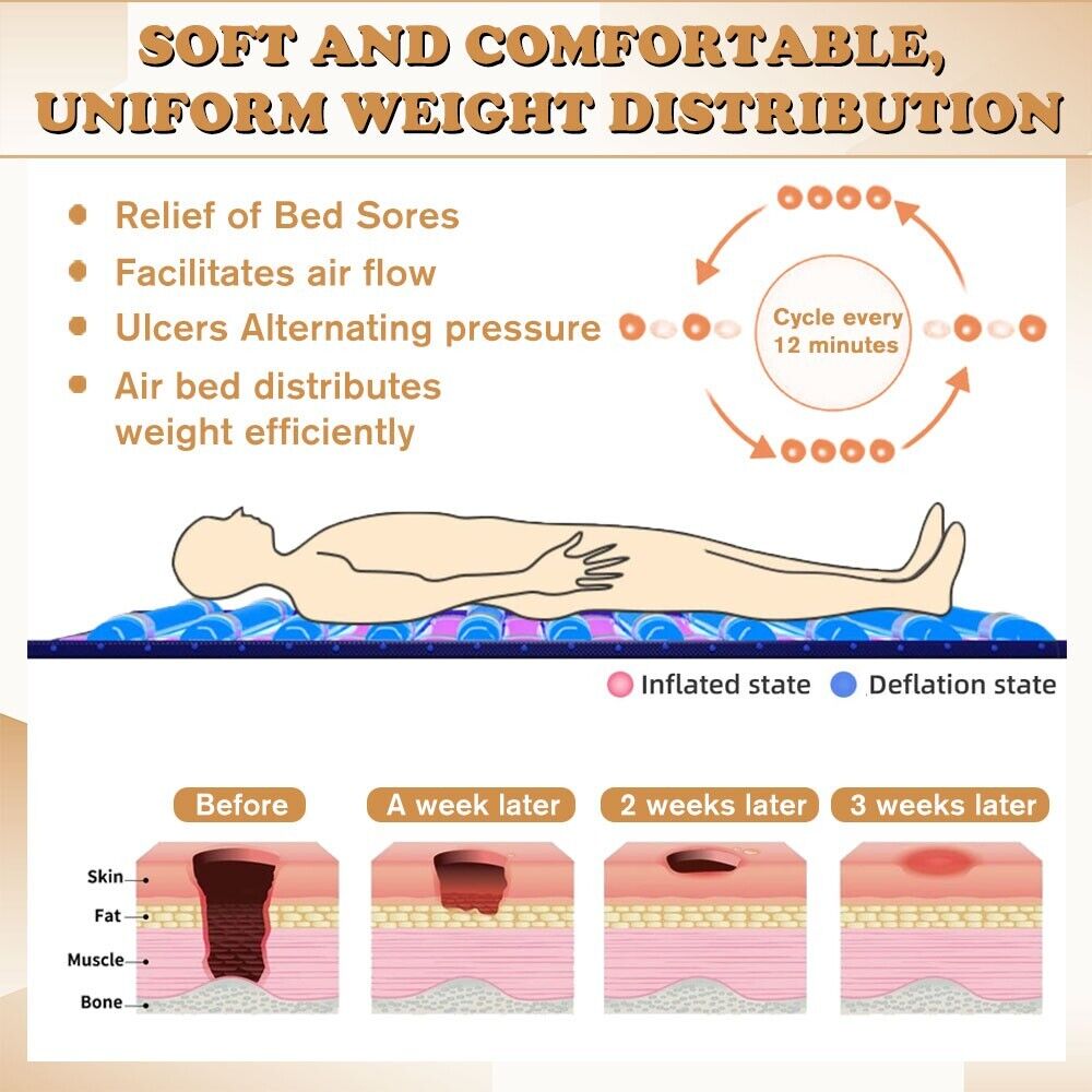Alternating Pressure Mattress Topper Medical Grade Bed Sore Prevention Treatment