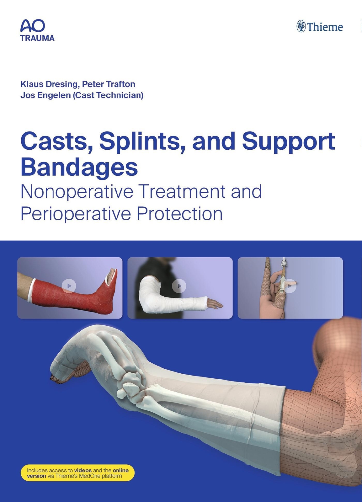 Casts, Splints, And Support Bandages, Klaus Dresing